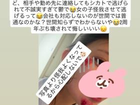 卷入事故被肇逃!仓木华受伤破相!